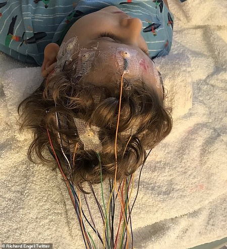 Richard Engel'S Second son  Henry Thomas Engel  Suffered from Rett Syndrome