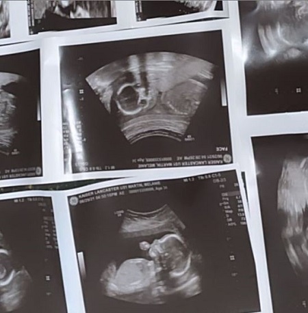 ron Carter and Melanie Martin are expecting a baby boy,