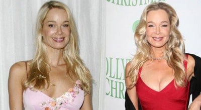 Before and After photo of Jennifer Gareis